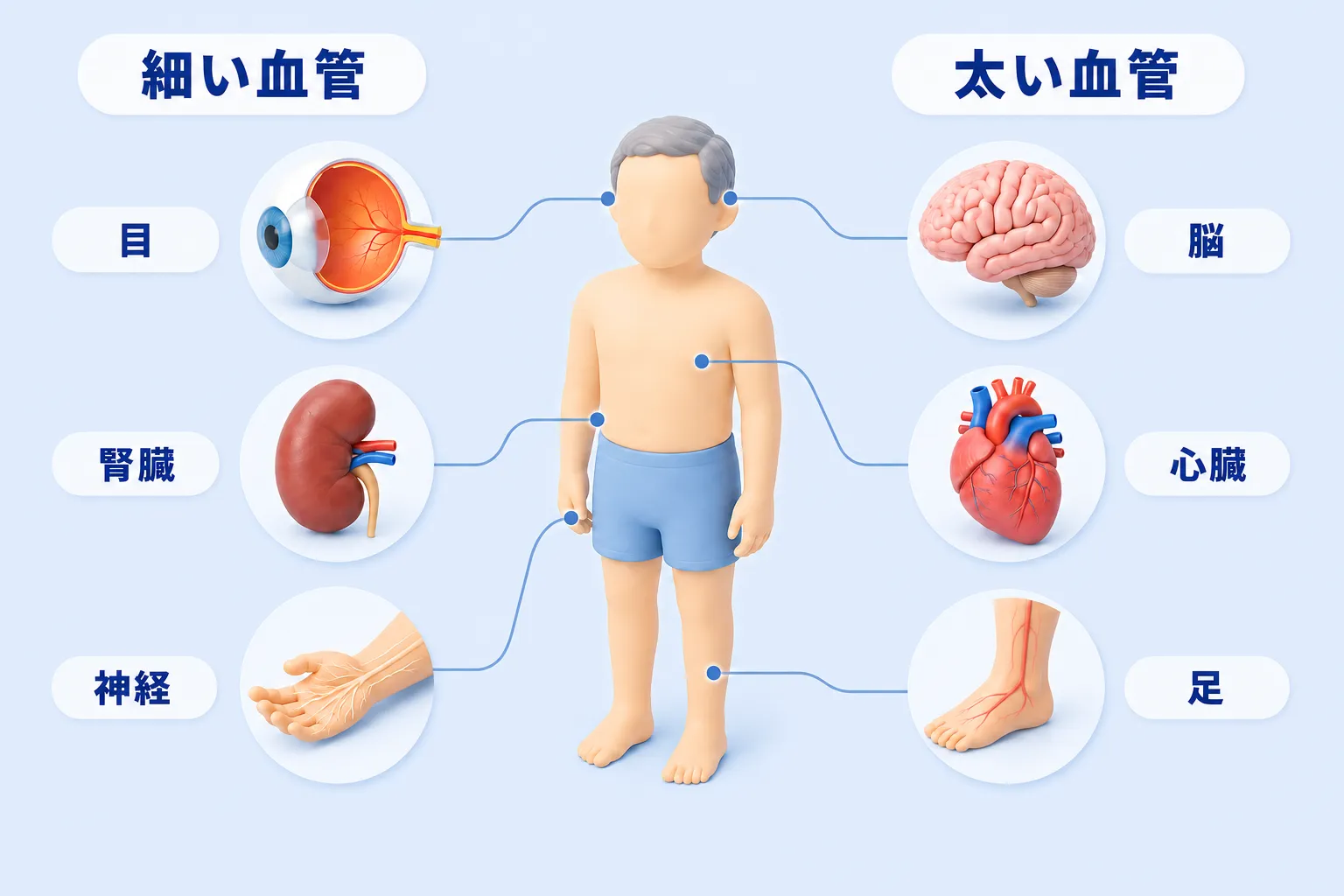 糖尿病で傷む全身の場所を人体マップで示した図。細い血管が傷むと目・腎臓・神経（手のしびれ）に、太い血管が傷むと脳・心臓・足に影響が及ぶことを表している。
