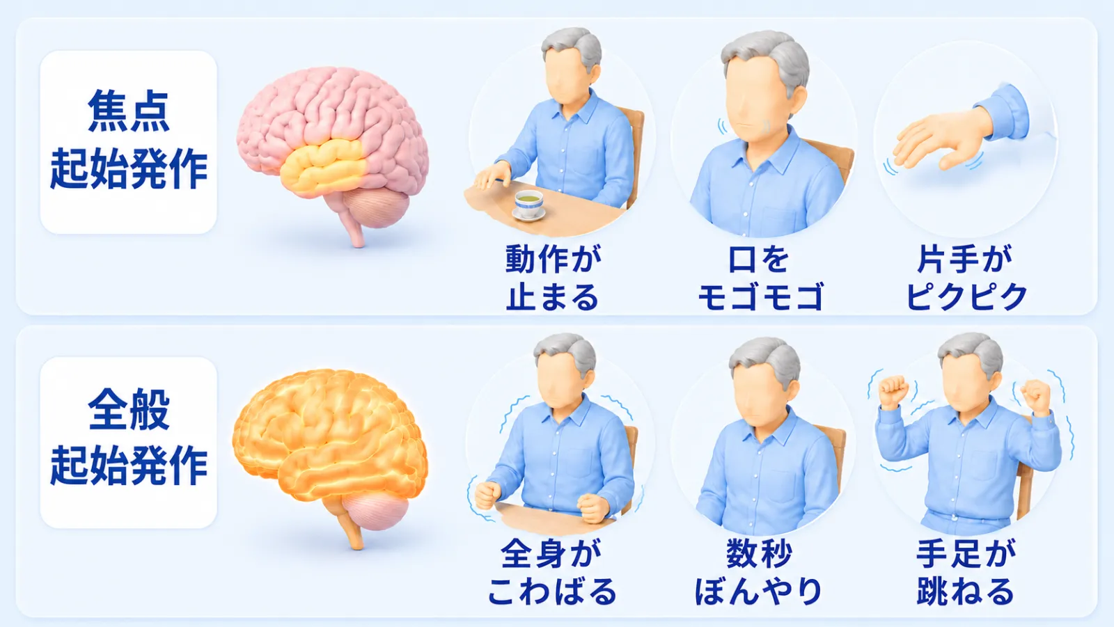 発作の2つのタイプを見比べる図解。上段の『焦点起始発作』は、脳の側頭葉にあたる一部分だけが光っており、動作が止まる・口をモゴモゴ動かす・片手だけがピクピクする、という症状を示している。下段の『全般起始発作』は、脳全体が光っており、全身がこわばる・数秒ぼんやりする・手足が跳ねる、という症状を示している。