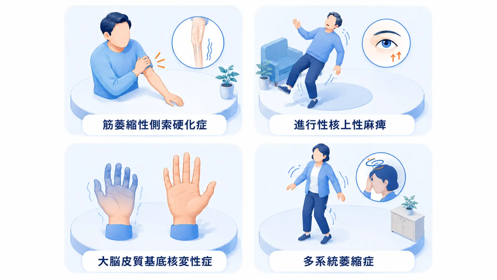 神経変性4疾患それぞれの代表的なサインを2×2で並べたイラスト。筋萎縮性側索硬化症＝手足の力が抜けて腕の筋肉がやせる、進行性核上性麻痺＝後ろへ転びやすく上を見る目の動きが苦手、大脳皮質基底核変性症＝片手だけ思うように使えない左右差、多系統萎縮症＝ふらつき・立ちくらみ。各パネルに病名ラベルを付けている。