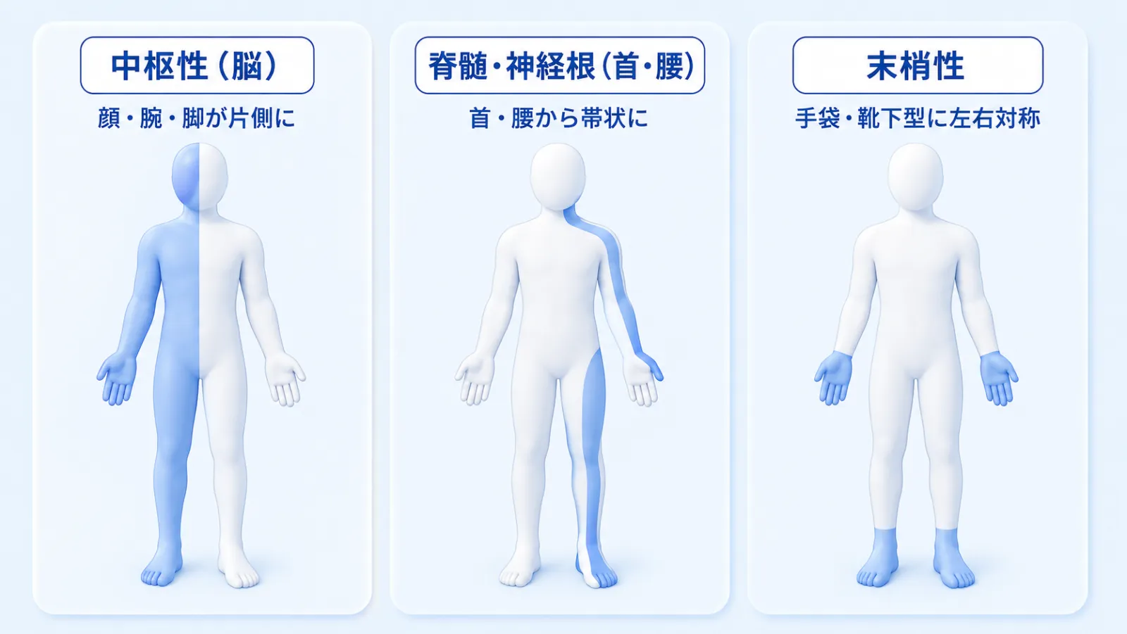 しびれ・麻痺の出る場所で原因の場所を絞り込む図解。3つの人体図を横に並べて対比している。左『中枢性（脳）』は体の片側（顔・腕・脚）がまとまってしびれることを、中央『脊髄・神経根（首・腰）』は片方の腕と脚に帯状にしびれが走ることを、右『末梢性』は両手の指先と両足先が手袋・靴下型に左右対称でしびれることを示している。
