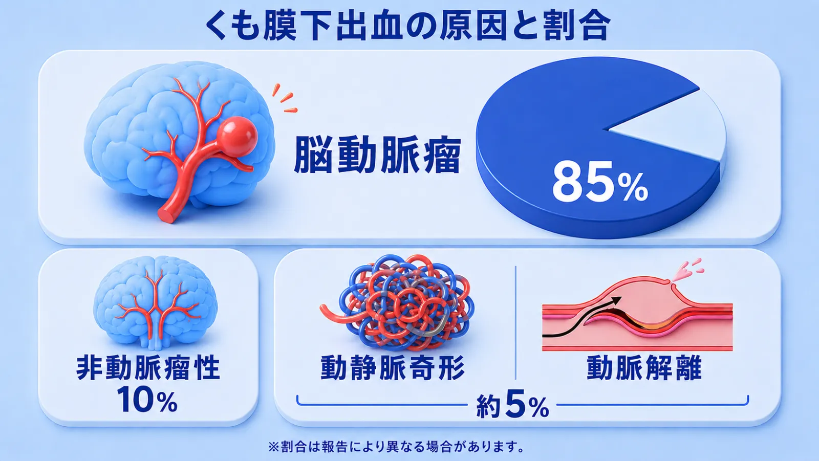くも膜下出血の原因と割合を示した図。最も多い原因は脳動脈瘤の破裂で全体の約85%を占めることを円グラフで大きく示し、続いて経過の良い特殊なタイプ（非動脈瘤性）が約10%、脳動静脈奇形や動脈解離などのその他が約5%であることを挙げている。割合は報告により異なる場合があることを注記している。