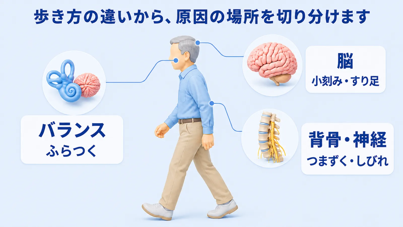 歩き方の違いから原因の場所を切り分ける人体マップ。脳（小刻み・すり足）、背骨・神経（つまずく・しびれ）、バランス（ふらつく）の3つに分けて示す。