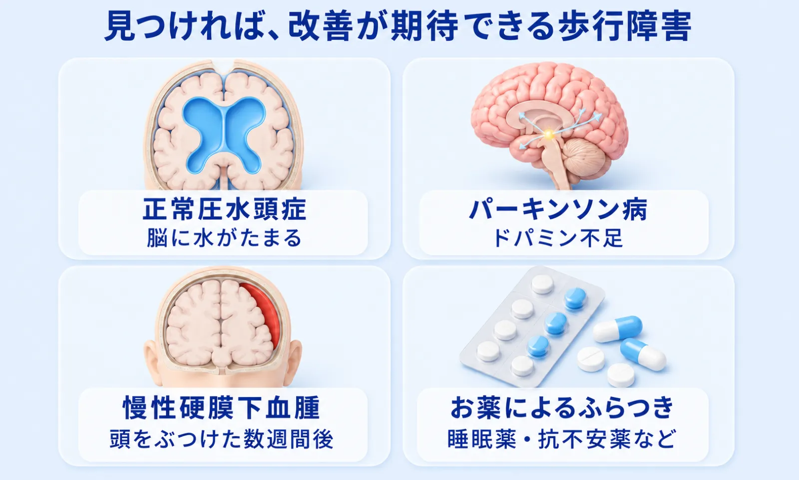 見つければ改善が期待できる歩行障害の4つの原因。正常圧水頭症（脳に水がたまる）、パーキンソン病（ドパミン不足）、慢性硬膜下血腫（頭をぶつけた数週間後）、お薬によるふらつき（睡眠薬・抗不安薬など）。